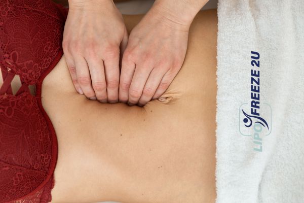 diastasis recti treatment Lymington