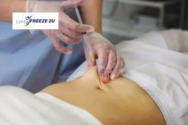 How Does Aqualyx Fat Dissolving Injection Work to Break Down Fat Lymington?