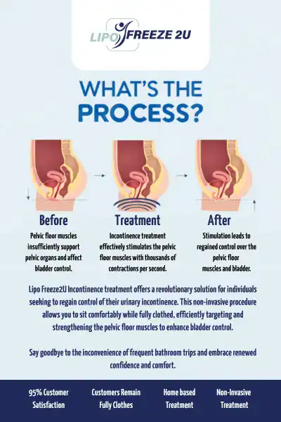 Diagram of how incontinence treatment Lymington works.