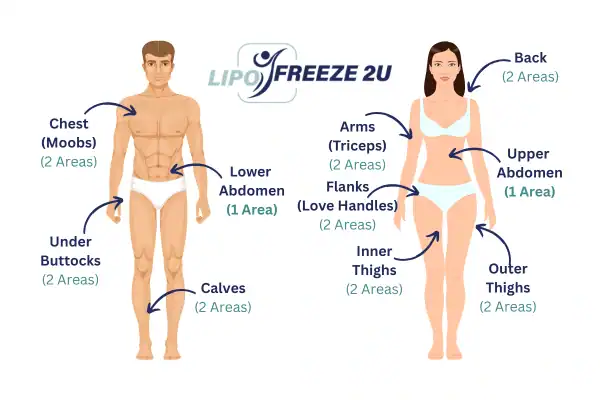Areas you can have fat freezing treatment Lymington