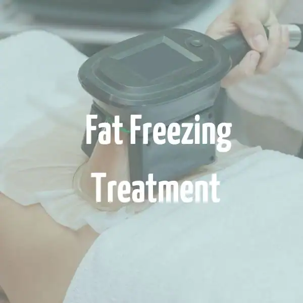 fat freezing treatment Lymington