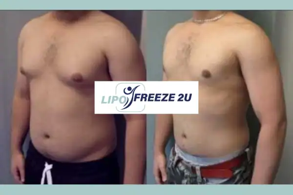How Long Does It Take to See Results Lymington?