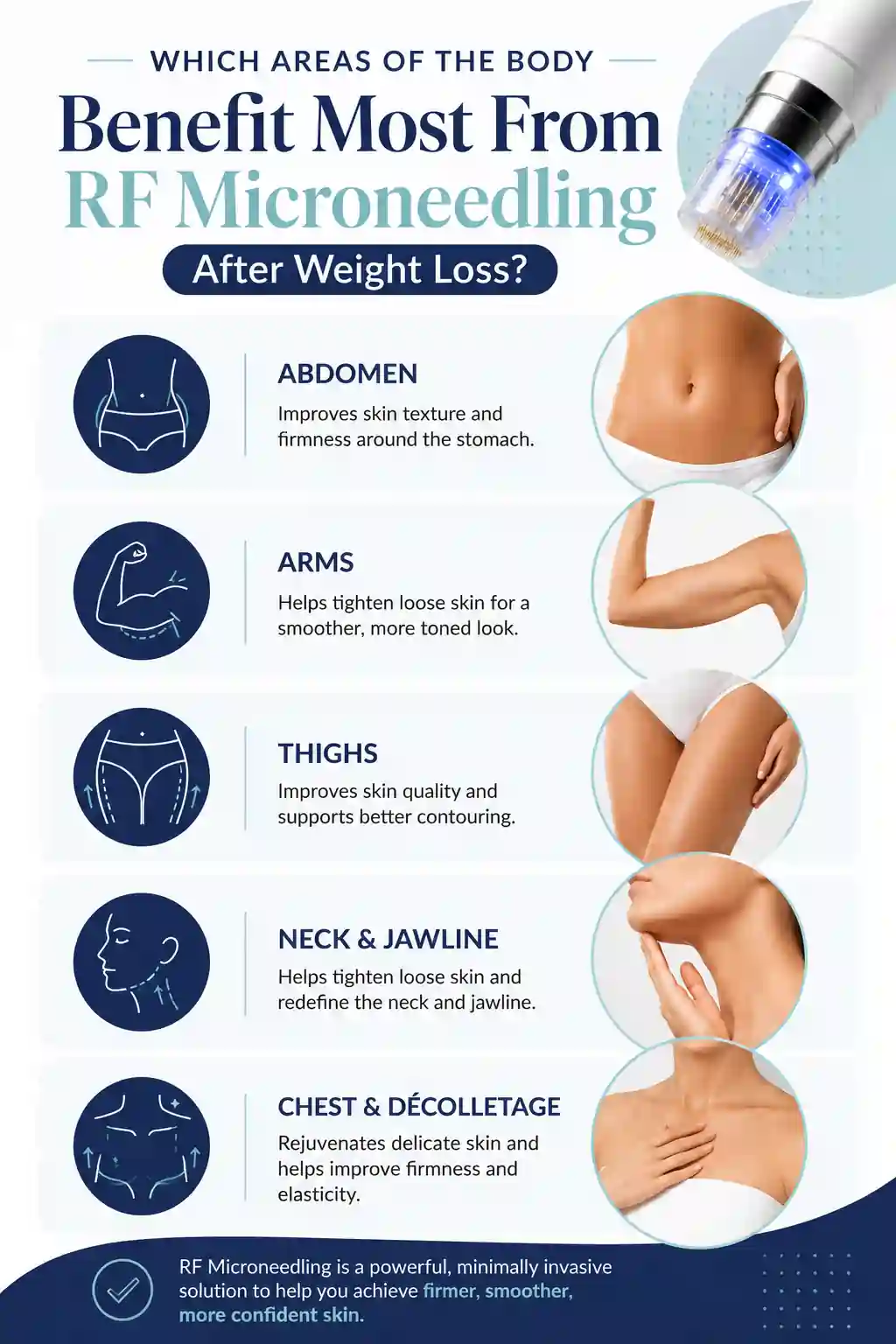 Which Areas of the Body Benefit Most From RF Microneedling After Weight Loss Lymington